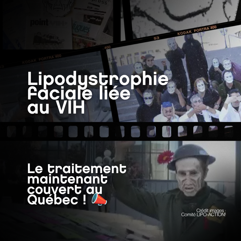 Le traitement pour la lypodystrophie est enfin couvert